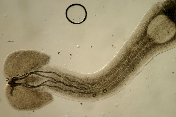 Parasites play crucial roles in keeping ecosystems healthy, as does this larval trypanorhynch tapeworm, which infects fish.