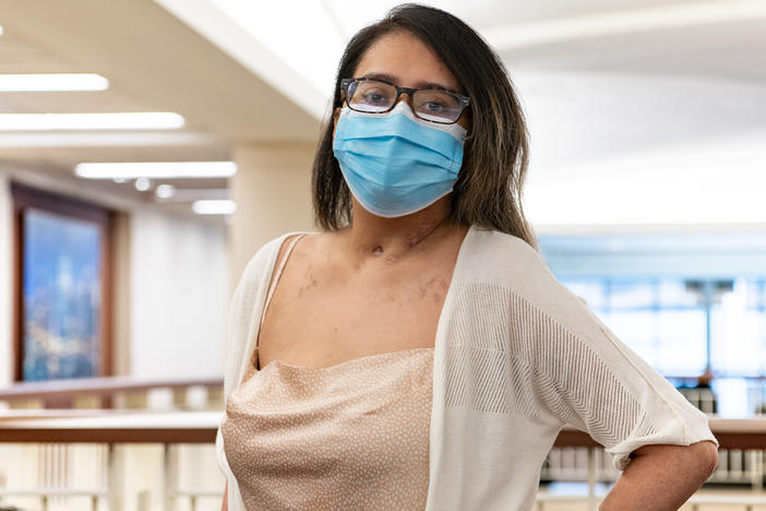 Mayra Ramirez received a double lung transplant after COVID-19 caused irreversible damage to her lungs.
