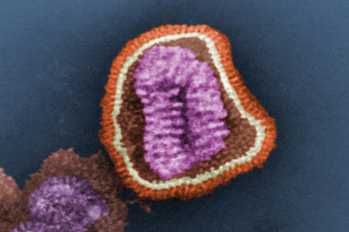 This negative-stained transmission electron micrograph depicts the ultrastructural details of an influenza virus particle, or virion.