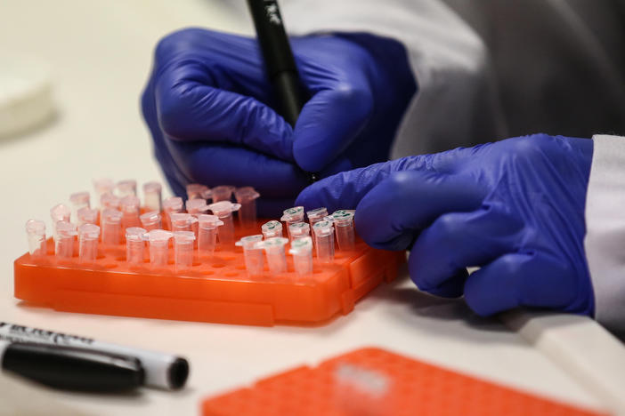 A scientist at work on a COVID-19 vaccine candidate at Bogazici University in Istanbul in August.