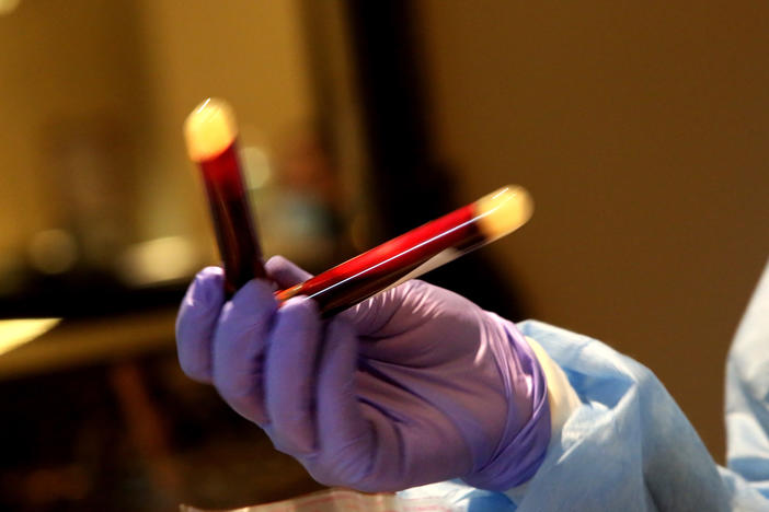 A new study that analyzed blood donations from December 2019 to early January helped show that the coronavirus infected people in the U.S. earlier than previously thought.