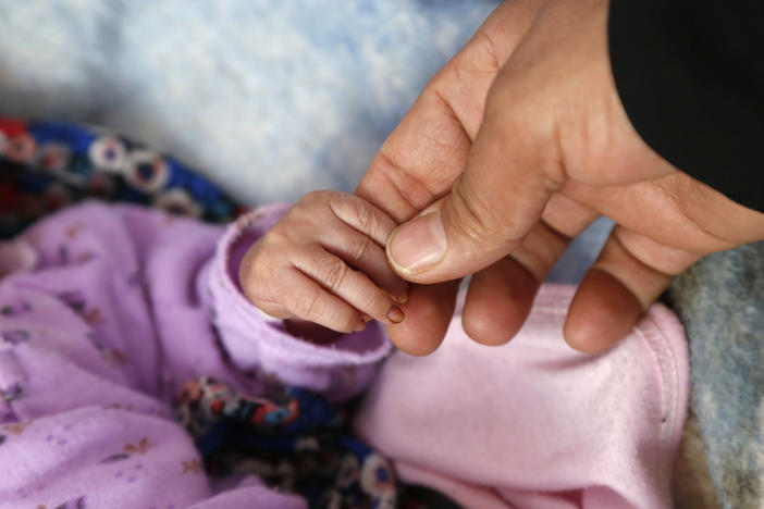 A nurse checks a child who is receiving treatment for malnutrition at a hospital in Sana'a, Yemen. The photo was taken on December 13.<strong></strong>