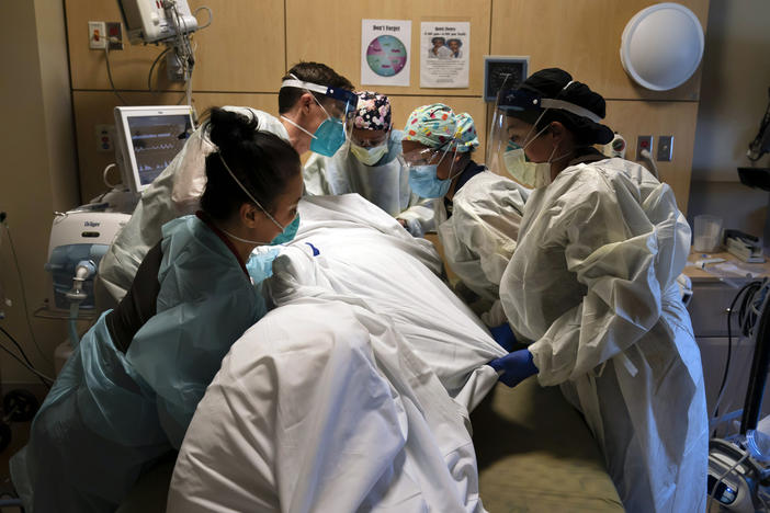 Hospital workers move a patient into the prone (face down) position, which can help increase the lung capacity of some COVID-19 patients. The medical team was photographed Nov. 19 at Providence Holy Cross Medical Center in Los Angeles.