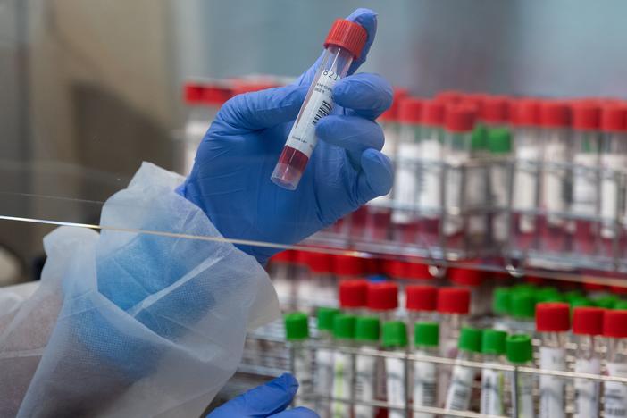 A laboratory technician is pictured handling swab samples at a hospital in Mulhouse, France, in November. French officials confirmed the country's first case of the new coronavirus variant on Friday.