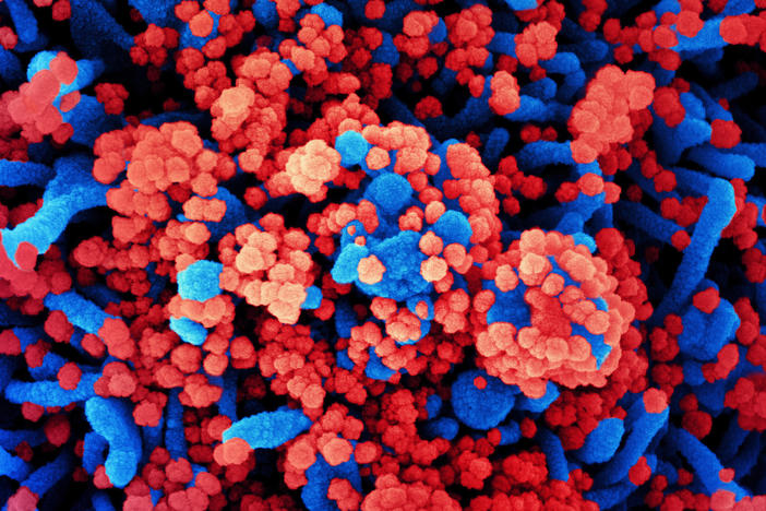 SARS-CoV-2 virus particles, shown in red, have heavily infected a cell in this colorized scanning electron micrograph. SARS-CoV-2 is the virus that causes COVID-19.