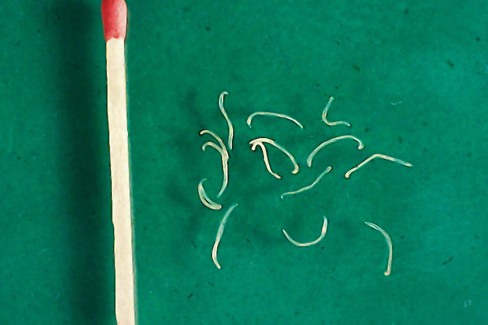 Adult hookworms from a dog. The larvae, which penetrate the skin, are even smaller.