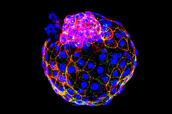 Jun Wu's team at the University of Texas Southwestern Medical Center in Dallas have created hollow balls of cells that closely resemble embryos at the stage when they usually implant in the womb — known as blastocysts. The new laboratory-made embryo-like entities have been dubbed "blastoids."