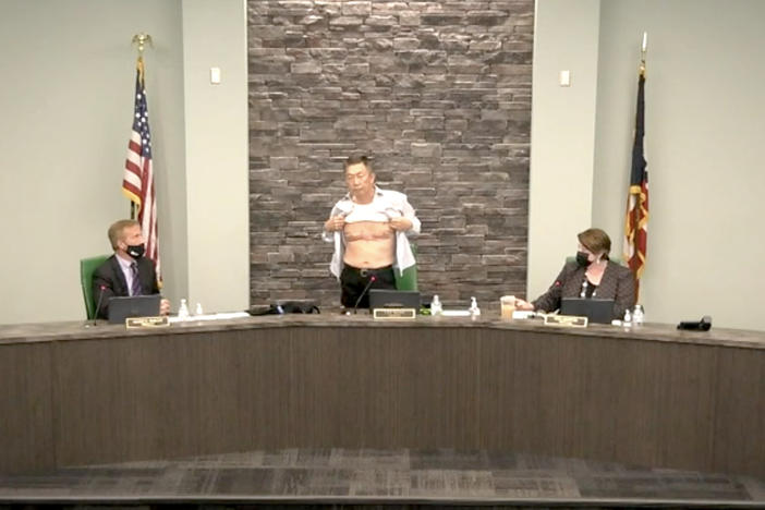 West Chester, Ohio, Board of Trustees Chairman Lee Wong bares his chest at a meeting Tuesday. Those scars, suffered during his U.S. military service, are "proof" of his patriotism, he said.