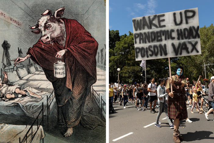 Left: A drawing of a human with a cow head holding a needle menacingly toward a child as he administers a tainted smallpox vaccination was meant to sow distrust of smallpox vaccines. Right: Protesters against COVID-19 vaccinations hold a rally in Sydney in February.