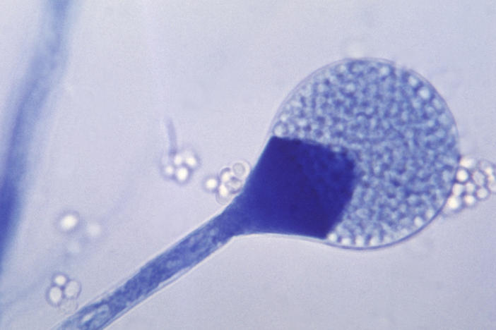 A light micrograph of a mature sporangium of a mucor fungus. India is seeing a rise in cases of mucormycosis, a rare but dangerous fungal infection.