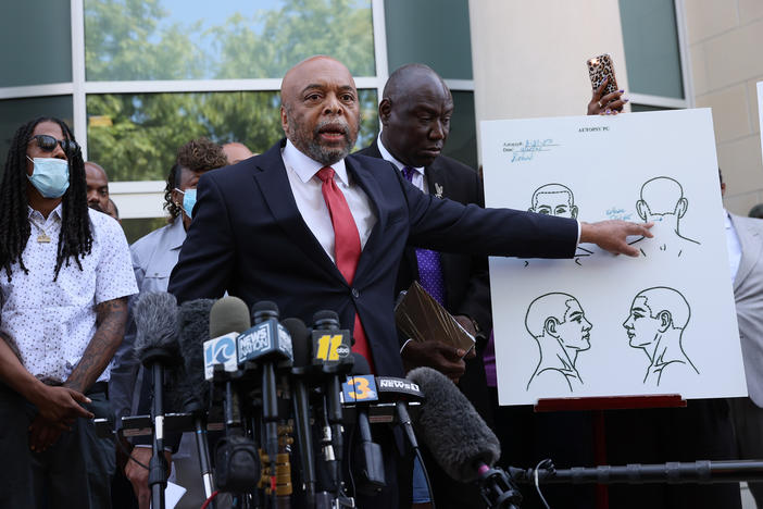 Speaking to reporters on April 27 in Elizabeth City, N.C., Wayne Kendall, one of the lawyers representing the family of Andrew Brown Jr., points to an autopsy chart showing where Brown was shot.