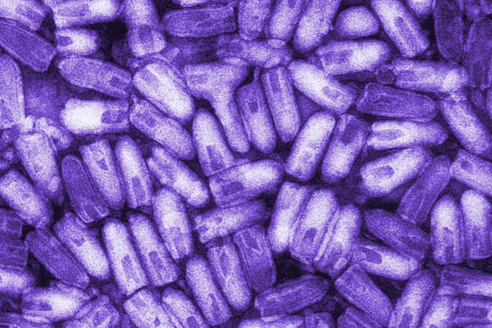 The infectious and contagious rabies virus, shown here in a colorized micrograph, can be transmitted to humans through the bite or saliva of an infected animal. Thanks to protective vaccination of pets, rabies was eliminated from the U.S. dog population in 2007, though a bite from infected bats, skunks and raccoons can still transmit the virus.