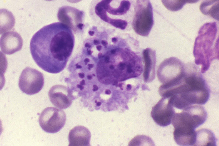 This photomicrograph depicts <em>Leishmania donovani</em> parasites contained within a canine bone marrow cell. O<em>ne of the more dangerous of 20 d</em>ifferent species of <em>Leishmania</em>,<em> L. <em>donovani </em>is endemic to parts of India, Africa, and South-West Asia.</em>