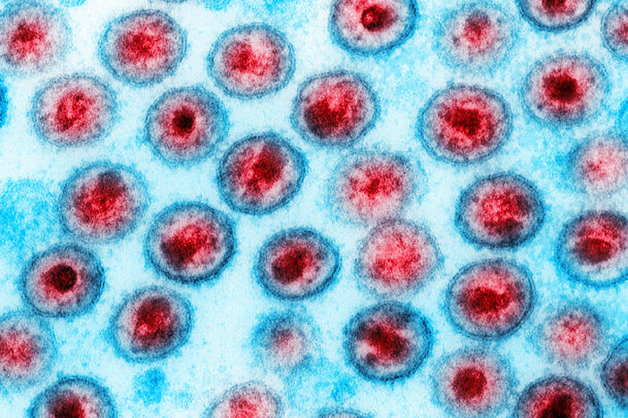 A computer-enhanced image of the HIV virus.