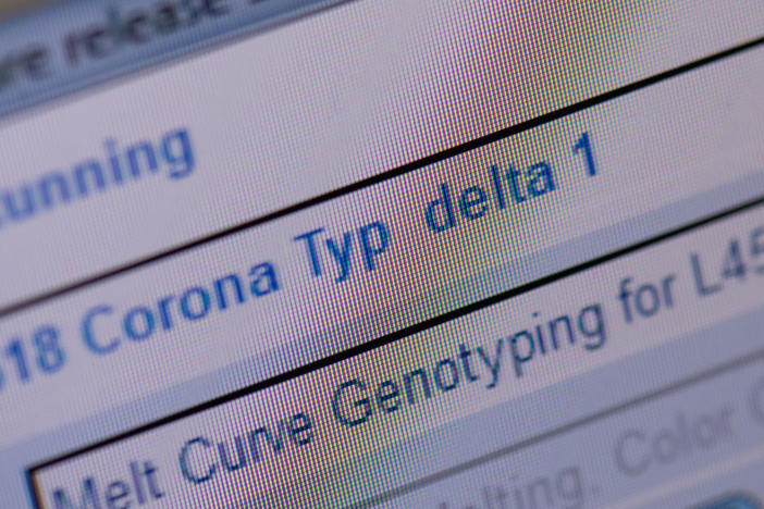 The delta variant, first detected in India, is spreading across the globe. In parts of the U.S., the strain accounts for more than 80% of new infections, according to CDC estimates.