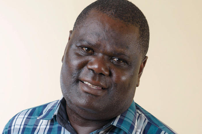 Zambian neurosurgeon, John Baptist Mukasa, passed away on TKTK.