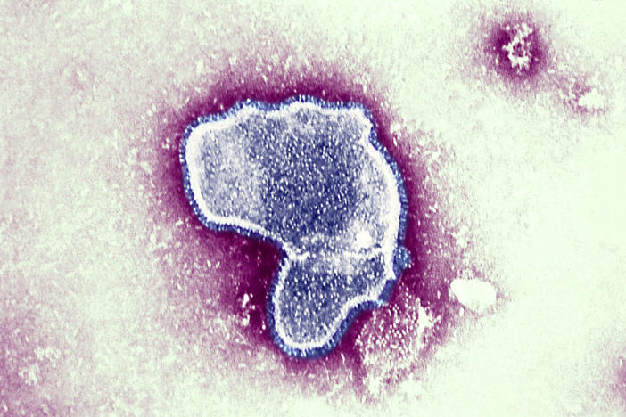At the moment there is little data available on the impact of contracting COVID-19 and the respiratory syncytial virus (pictured), and whether together they can make a person sicker. But health officials worry it could put young patients — who are not eligible for the coronavirus vaccine — at greater risk.