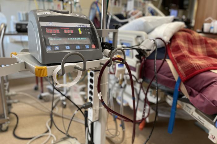 ECMO is the highest level of life support — beyond a ventilator, which pumps oxygen via a tube through the windpipe into the lungs. Instead, the ECMO process basically functions as a heart and lungs outside of the body — routing the blood via tubing to a machine that oxygenates it, then pumps it back into the patient.