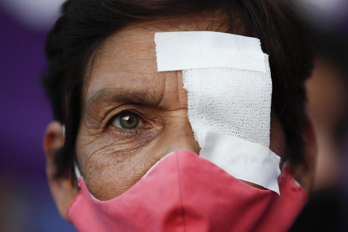 A woman has one eye covered to protest against gender violence, in Buenos Aires, Argentina, Wednesday, Feb. 17, 2021. Women from the "Ni Una Menos" or "Not One Less" movement marched to protest what they say is the negligence of judges when it comes to taking measures against aggressors of women.