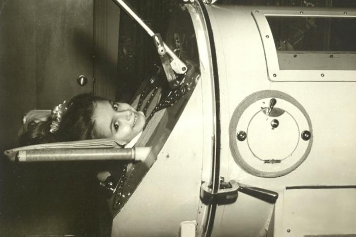 Martha Lillard needed a large respirator called an iron lung to recover from polio, which she caught in 1953. She still uses a form of the device at nights.