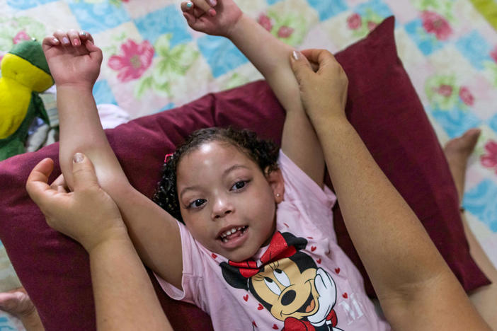 Rochelle dos Santos helps her daughter with physical therapy. Many children with congenital Zika disorder are physically disabled.