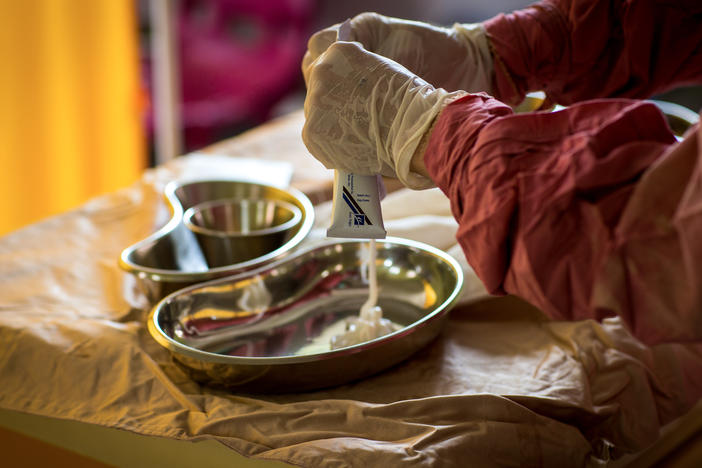 A nurse in the burn unit of the hospital in Afghanistan's Herat province prepares a topical ointment used to treat and prevent infections in burn patients.