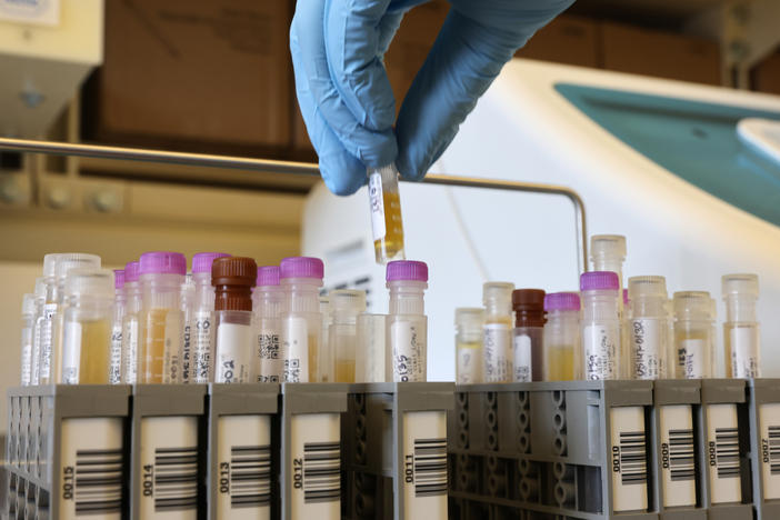 Researchers at the University of Washington Medicine Retrovirology Lab at Harborview Medical Center in Seattle process samples from Novavax's phase 3 COVID-19 vaccine clinical trial in February 2021.