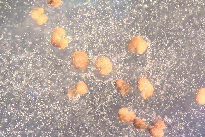 A dozen organisms designed by artificial intelligence known as xenobots (C-shaped; beige) beside loose frog stem cells (white).