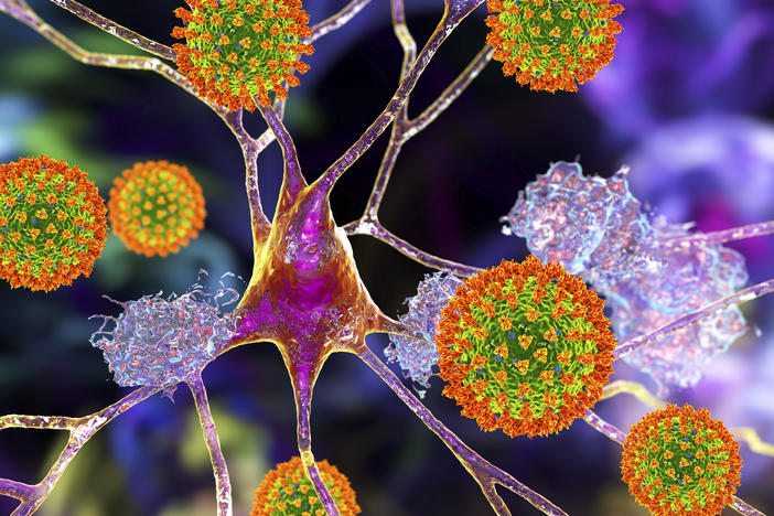 Researchers are learning that the coronavirus can infect neurons and may cause lasting damage in some cases.