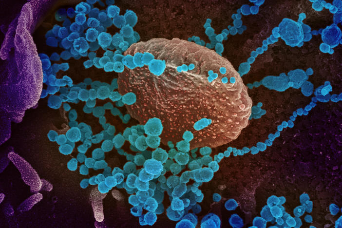 A colorized scanning-electron-microscope image shows SARS-CoV-2 (the round blue objects) emerging from cells cultured in the lab. SARS-CoV-2 is the coronavirus that causes the disease COVID-19.