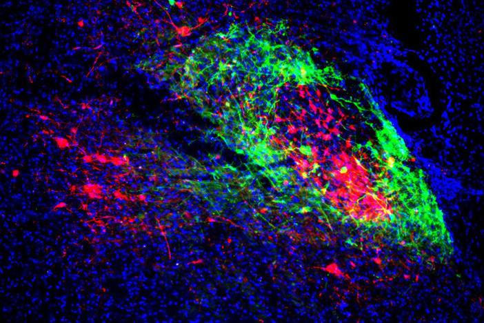 Shell neurons (green) project to the breathing center and core neurons (red) project to the pain/emotion center. Brain scientists have found the two are linked, shedding new light on opioid overdoses