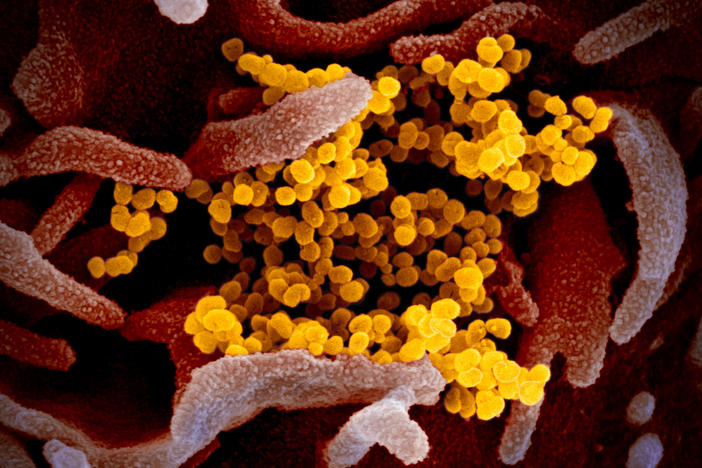 This colorized transmission electron micrograph image shows SARS-CoV-2, the coronavirus that causes the disease COVID-19. This specimen was isolated from a patient in the United States. Particles of the virus (yellow) are emerging from the surface of cells cultured in the lab (pink).