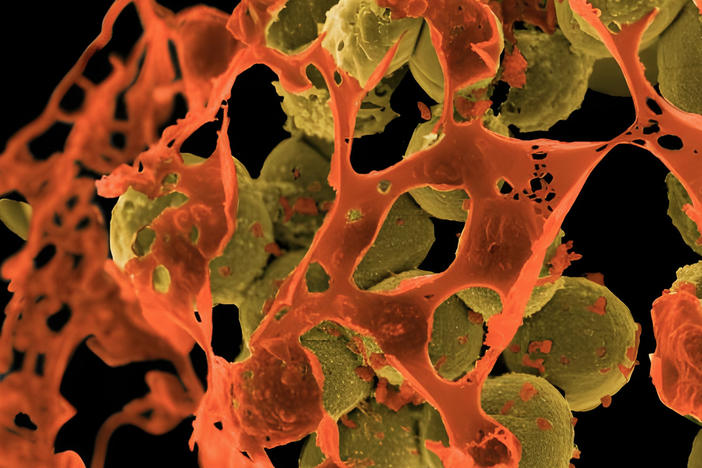 MRSA (methicillin-resistant <em>Staphylococcus aureus</em>), depicted above in yellow and surrounded by cellular debris, is a staph bacterium that resists treatment by many common antibiotics. The image is from a scanning electron micrograph.