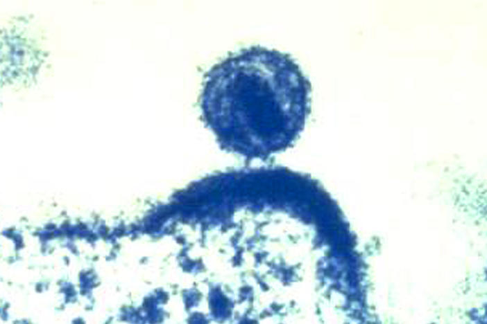 A colorized electron microscope image from the National Institute of Allergy and Infectious Diseases shows a single human immunodeficiency virus budding from a human immune cell.