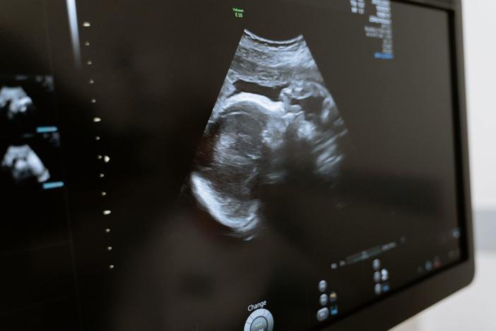 Vaccinating pregnant women against the coronavirus also helps protect their babies against COVID-19 after they are born,  according to new research.