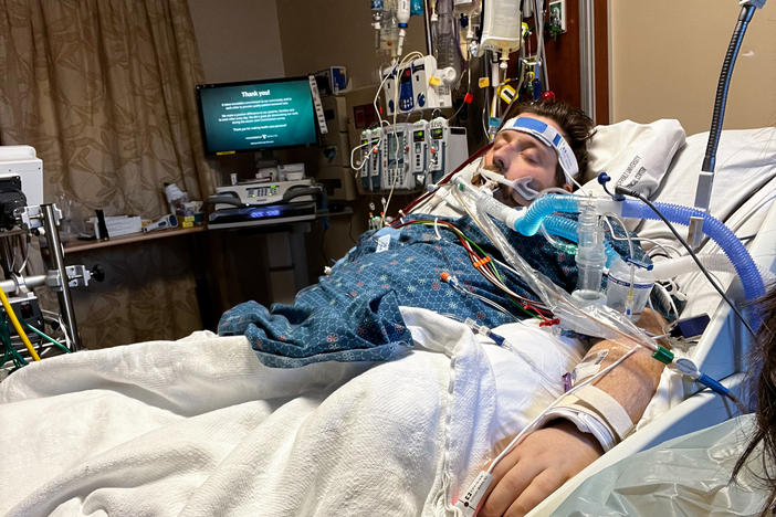 James Perkinson of Greenbriar, Tenn., underwent ECMO for nearly two months while he was sedated. He says without the "miracle" therapy, he "wouldn't be here right now."