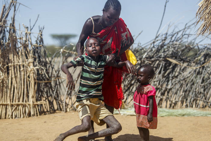 A mother helps her malnourished son stand after he collapsed near their hut in the village of Lomoputh in northern Kenya on Thursday. A severe drought and spiking food prices are causing a humanitarian emergency in the Horn of Africa.