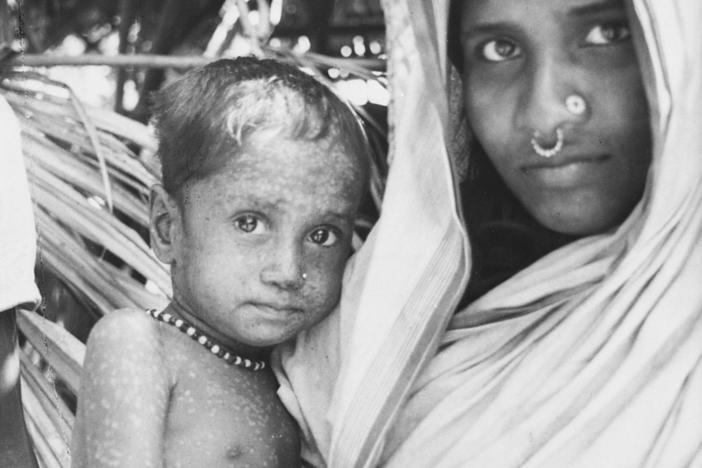 Rahima Banu, pictured with her mother in Bangladesh in 1975, is recorded as having the last known naturally-occurring case of the deadly form of smallpox.