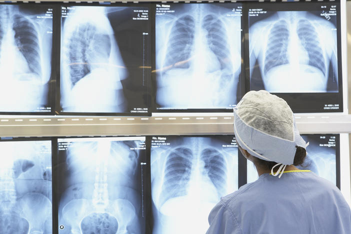 Some medical tests, such as MRIs done early for uncomplicated low back pain and routine vitamin D tests "just to be thorough," are considered "low-value care" and can lead to further testing that can cost patients thousands of dollars.