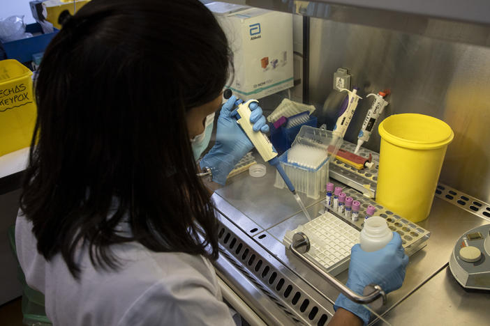 Europe is at the center of the monkeypox outbreak — and it must act quickly to prevent the virus from becoming established, the WHO says. Here, a medical laboratory technician works with suspected monkeypox samples to be tested at La Paz hospital in Madrid, Spain, last month.