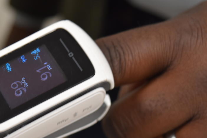 A pulse oximeter is worn by Brown University professor Kimani Toussaint. The devices have been shown in research to produce inaccurate results in dark-skinned people, and Toussaint's lab is developing technology that would be more accurate, regardless of skin tone.