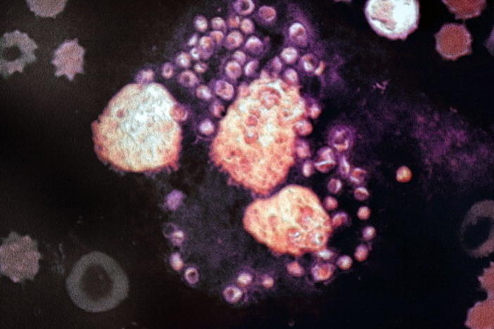 Dozens of <em>Leishmania</em> parasites (purple) surround 3 white blood cells (orange) in this image magnified 1,000 times.