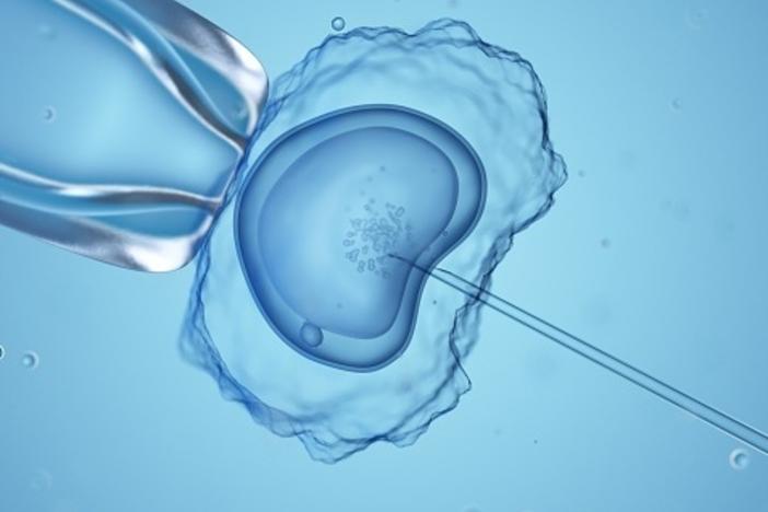 In states that outlaw abortion, some patients and health care workers worry that in vitro fertilization could be in legal jeopardy too.
