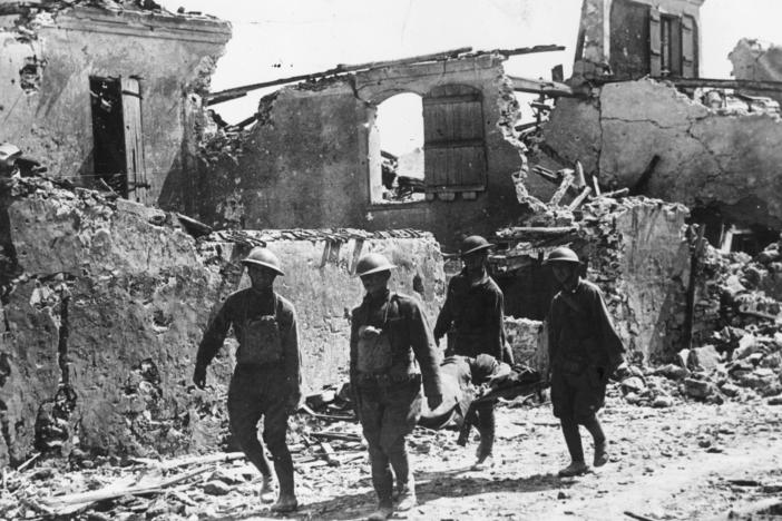 Four American soldiers carry a wounded soldier on a stretcher in Vaux, France, on July 22, 1918. As many as 280,000 World War I combatants were left with facial injuries.