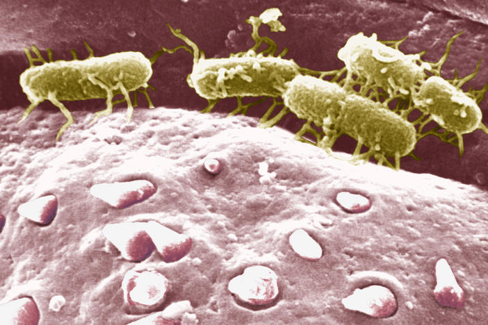 Scanning electron micrograph of <em data-stringify-type="italic">Salmonella typhi</em>, the parasite that causes typhoid fever (in yellow-green, attached to another bacterial cell.