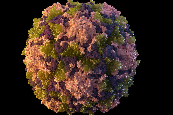 New York health officials detected Polio in a patient Thursday, the first case in the United States since 2013. The signature symptom of the Polio virus is paralysis, which can return later in life, years after a survivor has recovered from their initial infection.