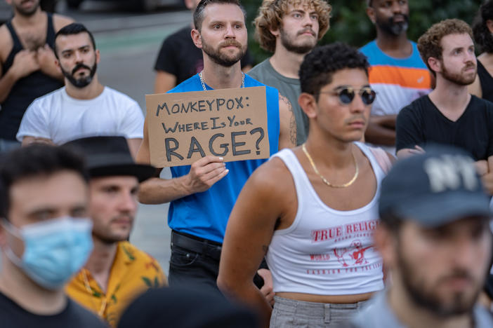 People protest during a rally calling for more government action to combat the spread of monkeypox at Foley Square on July 21, 2022 in New York City.