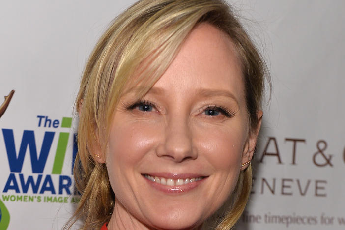 Actress Anne Heche attends the WIN Awards at Santa Monica Bay Womans Club on December 11, 2013 in Santa Monica, California.