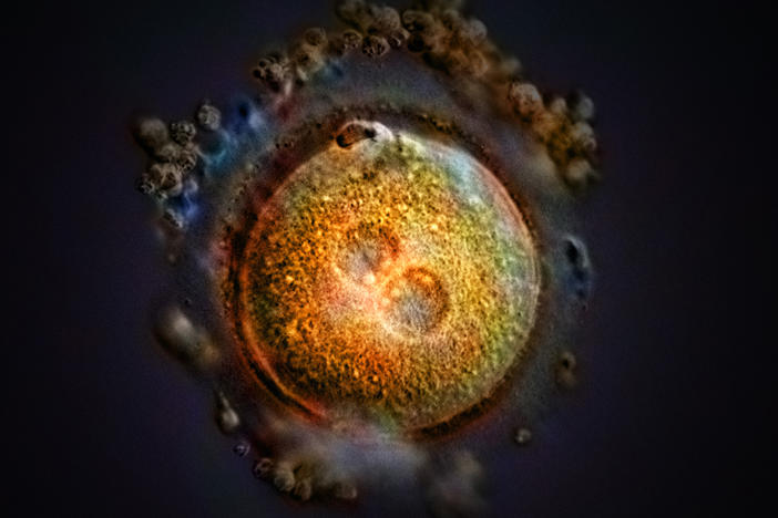 This computer-generated image shows the formation of a zygote after fertilization. Some Republican-led states, including Arkansas, Kentucky, Missouri, and Oklahoma, have passed laws declaring that life begins at fertilization, a contention that opens the door to a host of pregnancy-related litigation.