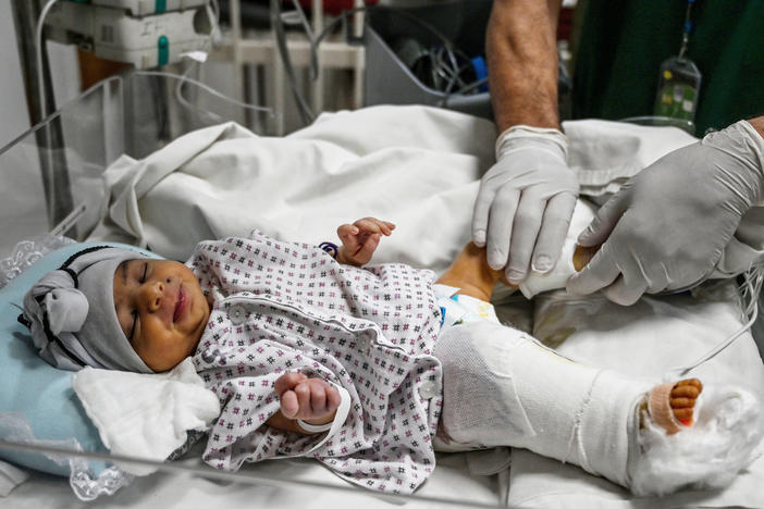 Newborn baby Amina is treated for the gun wound in her right leg incurred during the May 12, 2020 attack on a maternity hospital in Kabul. After being rescued, she was brought to the French Medical Institute for Children for surgery.